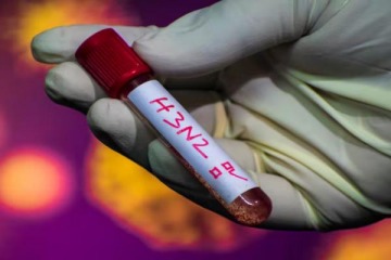 Foto de Confirman que la supergripe H3N2 llegó a la Argentina: detectan tres infectados
